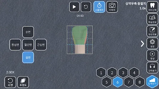 AR-D Morphology screenshot 7