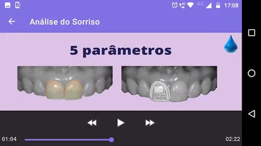 AnalisedoSorriso screenshot 8