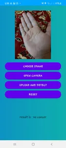 Skin Diagnosis SCU screenshot 11