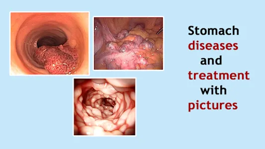 All Stomach Disease &Treatment screenshot 4