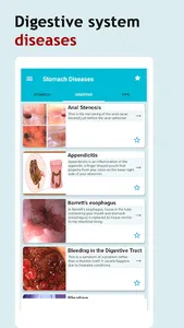 All Stomach Disease &Treatment screenshot 7