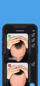 HairTrackr screenshot 14