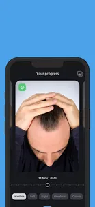 HairTrackr screenshot 3