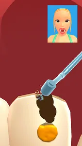 Teeth Digger 3D screenshot 1