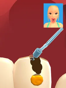 Teeth Digger 3D screenshot 11