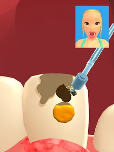 Teeth Digger 3D screenshot 12