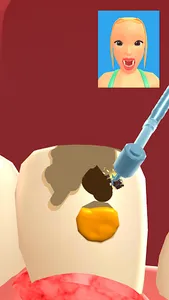 Teeth Digger 3D screenshot 2