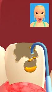 Teeth Digger 3D screenshot 3