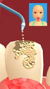 Teeth Digger 3D screenshot 4