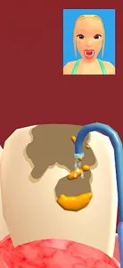 Teeth Digger 3D screenshot 8