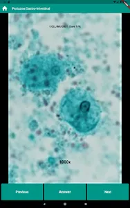 Human Parasitology Flashcard screenshot 10