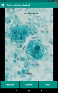 Human Parasitology Flashcard screenshot 6