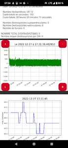 Polar H10 Arrhythmia screenshot 15