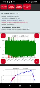 Polar H10 Arrhythmia screenshot 17