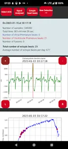 Polar H10 Arrhythmia screenshot 18