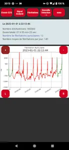 Polar H10 Fibrillation Search screenshot 0