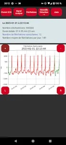 Polar H10 Fibrillation Search screenshot 12