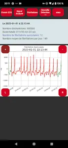 Polar H10 Fibrillation Search screenshot 2