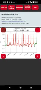 Polar H10 Fibrillation Search screenshot 4