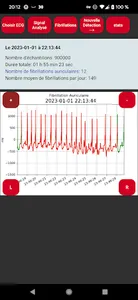 Polar H10 Fibrillation Search screenshot 7