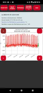Polar H10 Fibrillation Search screenshot 8