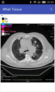 What Tissue Alpha screenshot 0