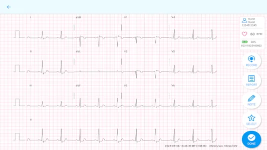 QT ECG Singapore screenshot 4