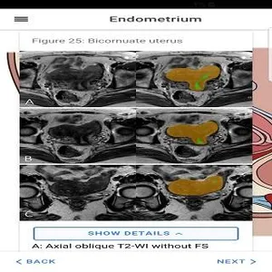 Radiology Simple Guide by I &  screenshot 2
