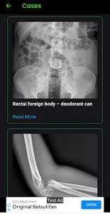 Radiography screenshot 7