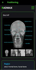 Radiography screenshot 9
