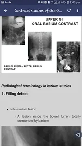 Abdominal X-ray screenshot 1