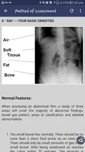 Abdominal X-ray screenshot 3