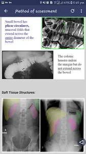 Abdominal X-ray screenshot 6