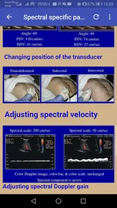 Doppler Ultrasounds screenshot 1