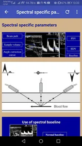 Doppler Ultrasounds screenshot 14