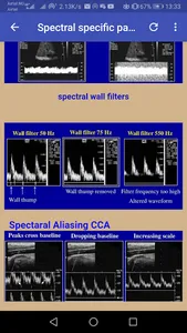 Doppler Ultrasounds screenshot 15
