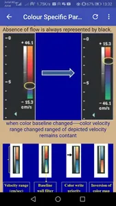 Doppler Ultrasounds screenshot 2