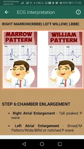 ECG Interpretation Part 1 screenshot 2