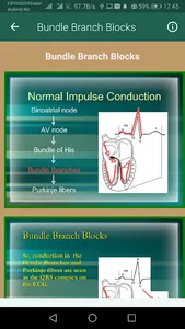 ECG Interpretation Part 1 screenshot 4