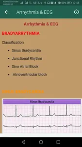 ECG Interpretation Part 1 screenshot 5