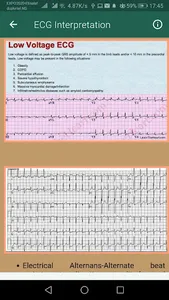ECG Interpretation Part 1 screenshot 8