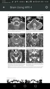 MRI Scan View Anatomy of Brain screenshot 0