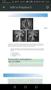 MRI Scan View Anatomy of Brain screenshot 1