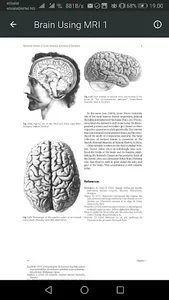 MRI Scan View Anatomy of Brain screenshot 2