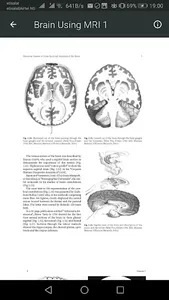MRI Scan View Anatomy of Brain screenshot 3