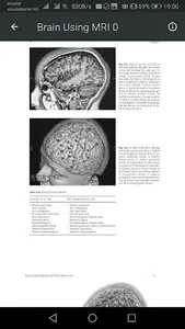 MRI Scan View Anatomy of Brain screenshot 5