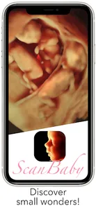 ScanBaby learn baby ultrasound screenshot 0