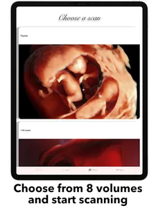 ScanBaby learn baby ultrasound screenshot 12