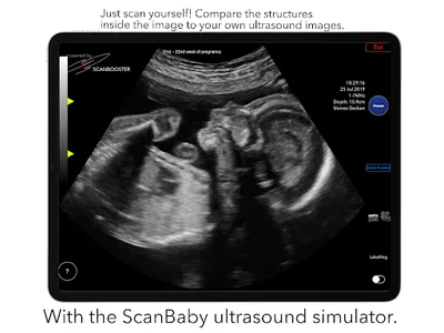 ScanBaby learn baby ultrasound screenshot 13