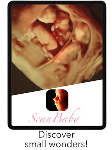 ScanBaby learn baby ultrasound screenshot 14